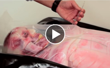 Security risks in the sensors of implantable medical devices